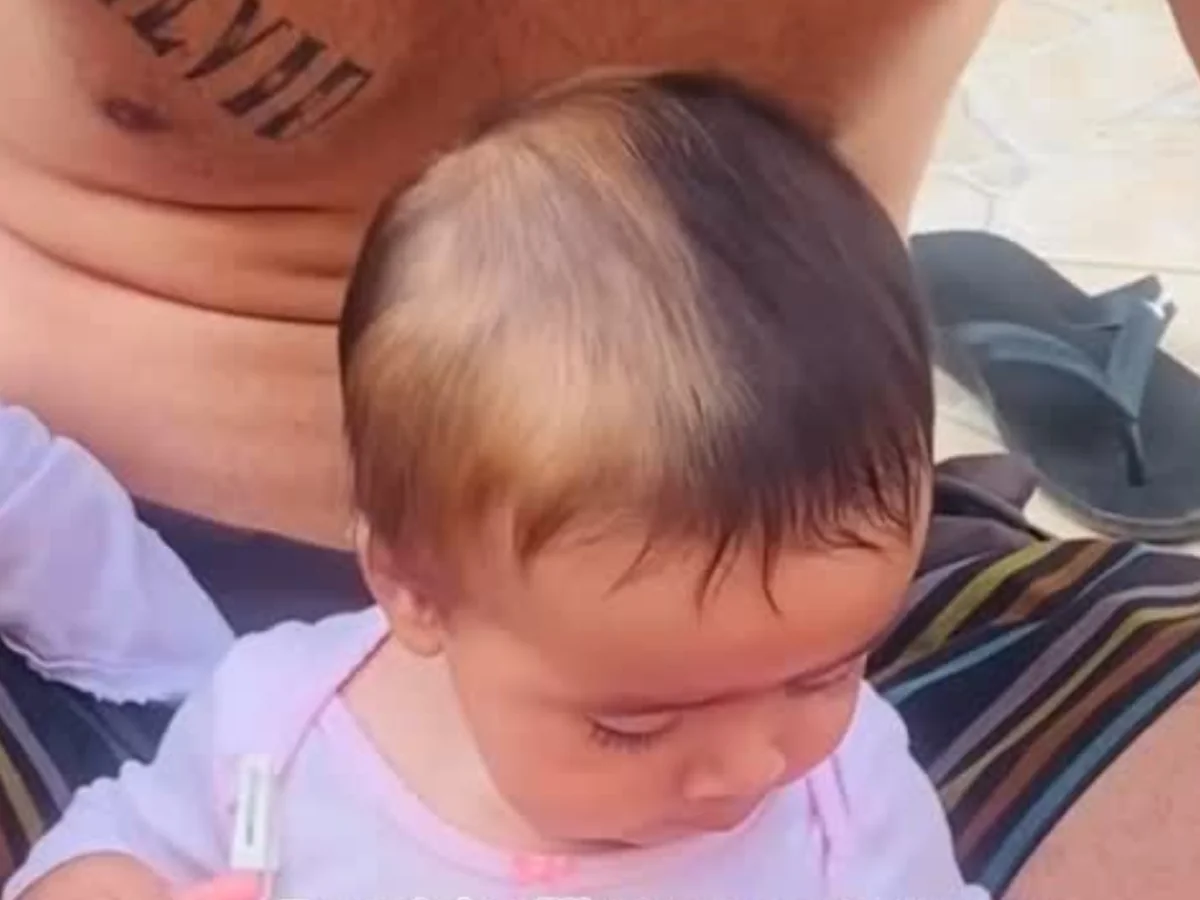 Mãe atualiza aparência de filha que nasceu com cabelo metade loiro e ...