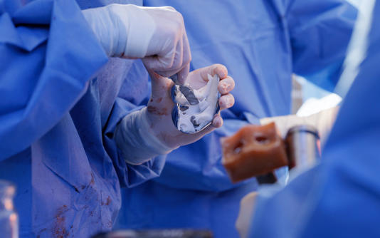 Bone cement is used in most of the 250,000 hip and knee operations carried out each year - Sergii Kolesnikov/iStockphoto