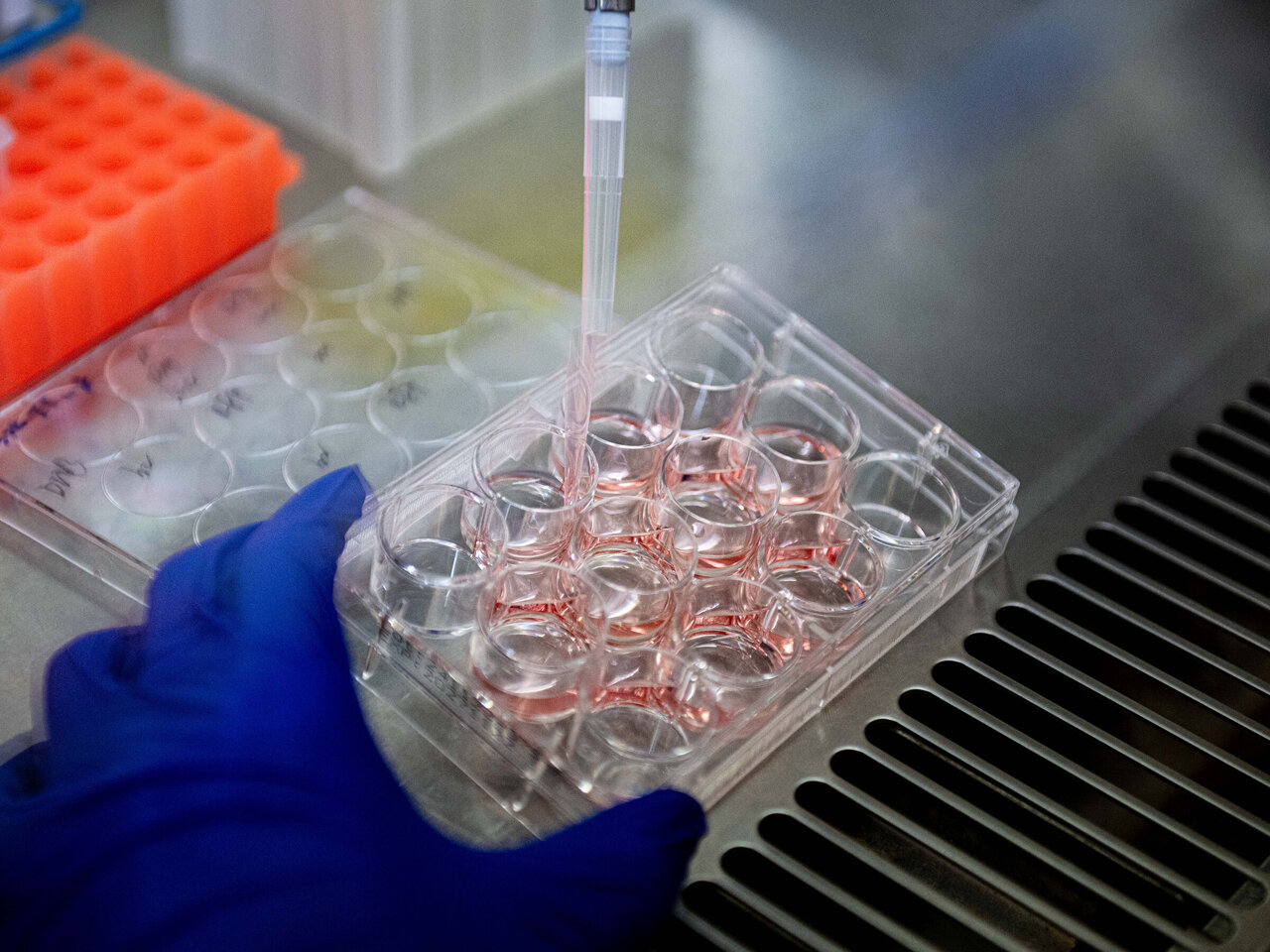 A hidden neuron 'gatekeeper' may shape Alzheimer's buildup of amyloid-beta
