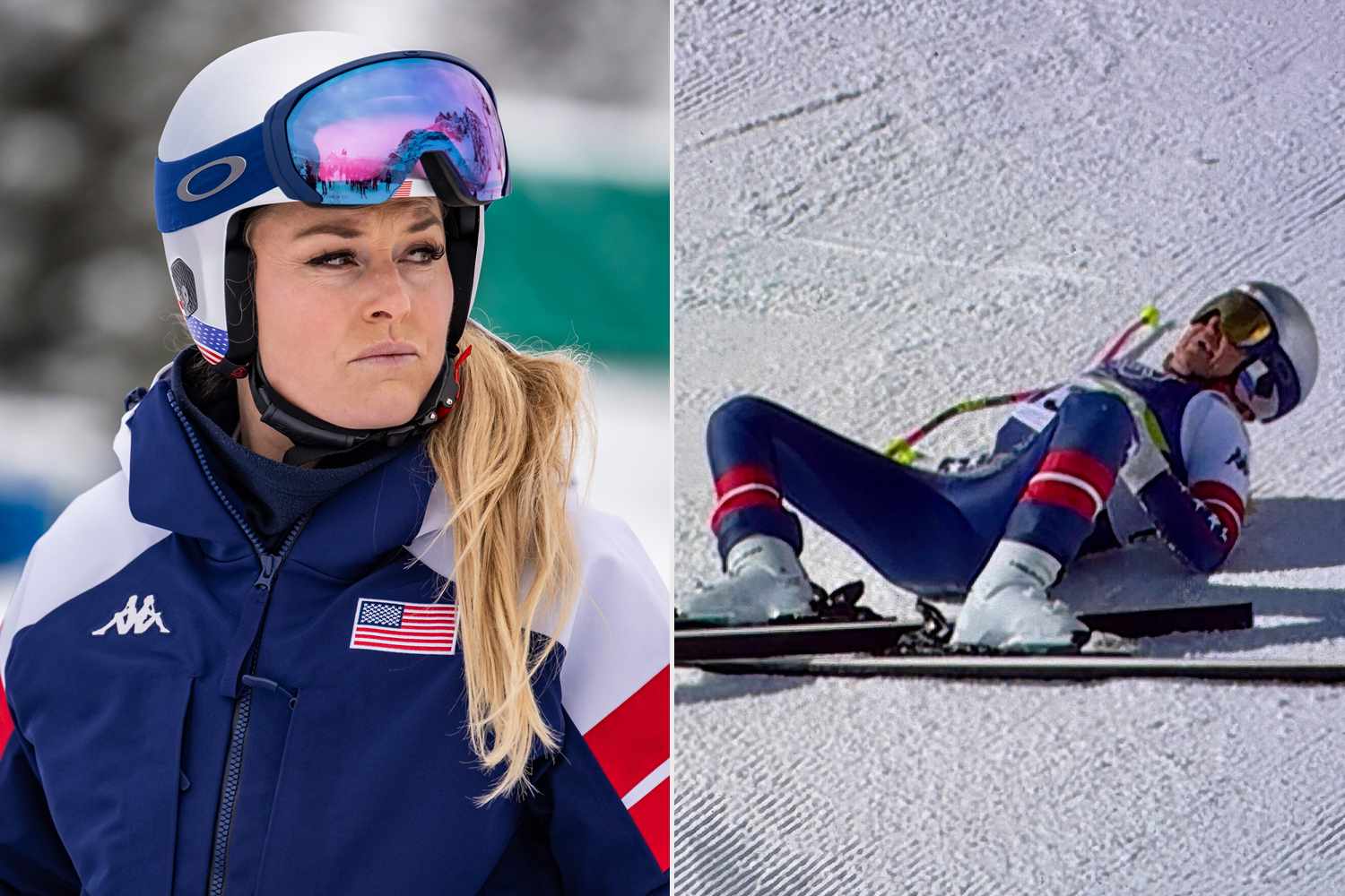 Doctor recaps the moment he raced to Lindsey Vonn's side after dramatic ...