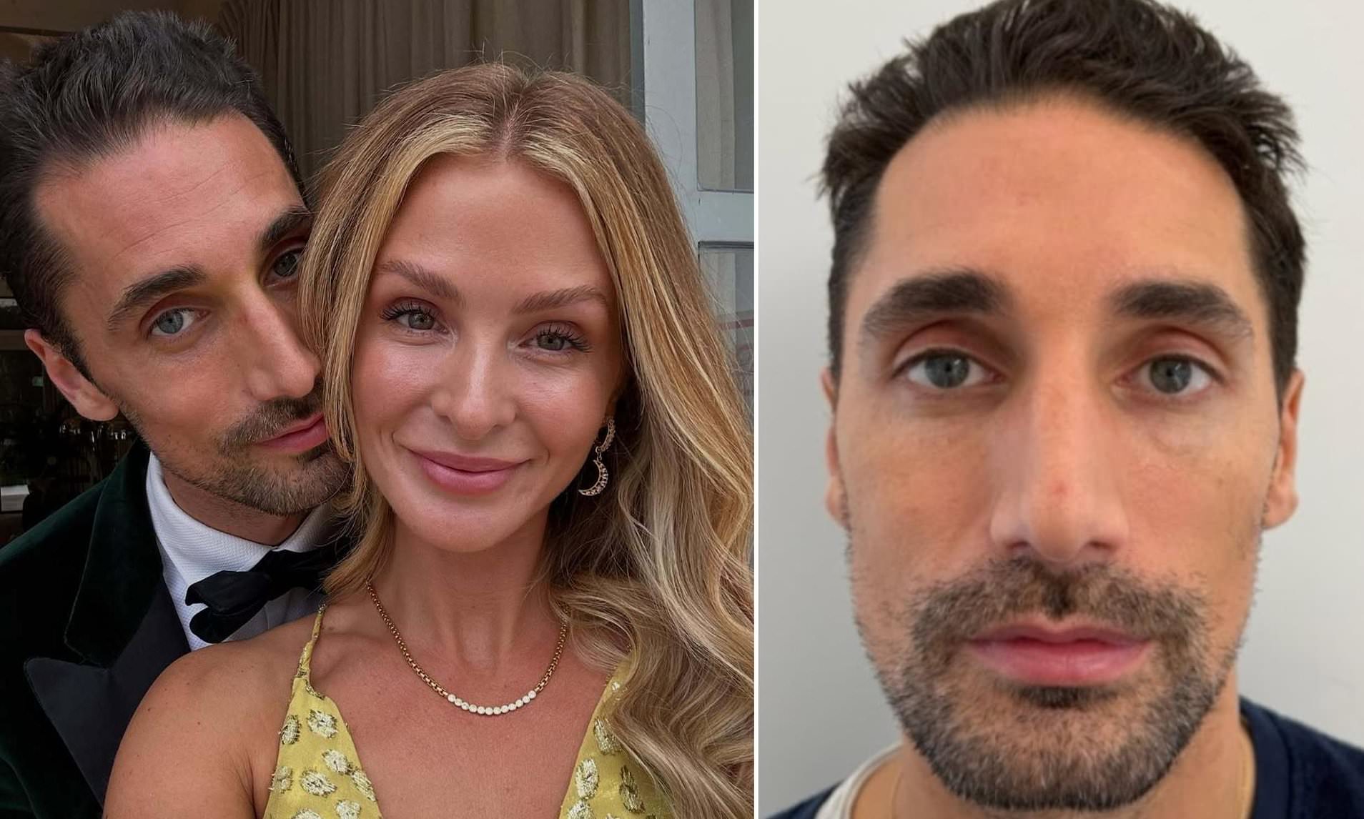 Hugo's post-Millie glow-up! Made in Chelsea star, 39, gets £3,300 ...