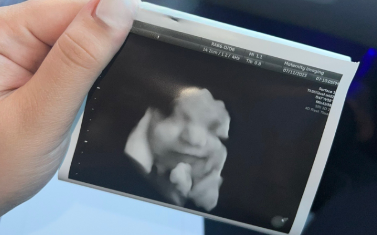 Mom-to-be gets crushing news during scan, 3 weeks later everything changes