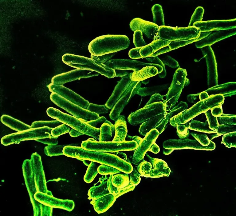 Frozen & fatal: The hidden bacteria thriving in grocery store freezers