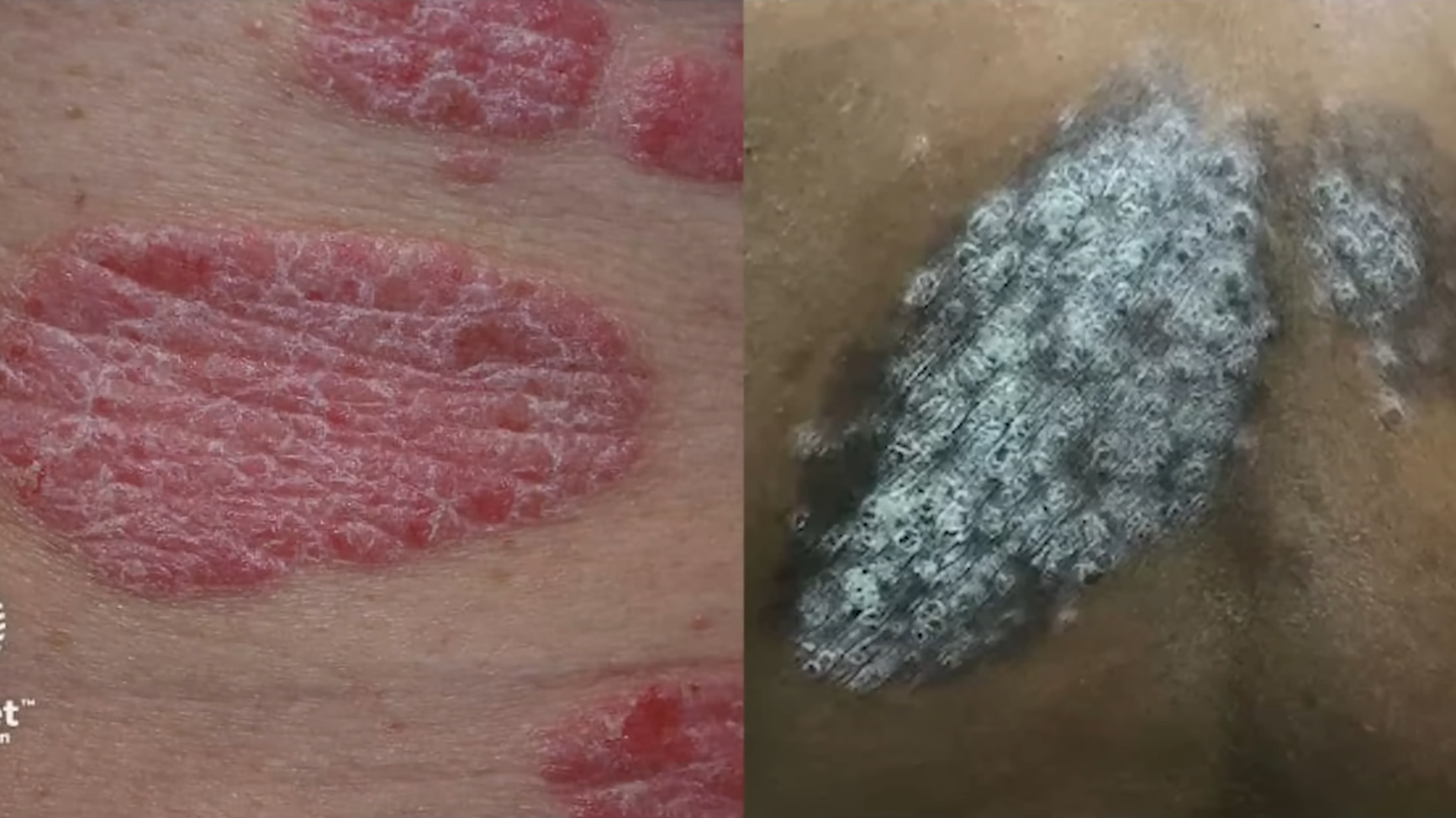 Warning signs your skin may reveal about your health