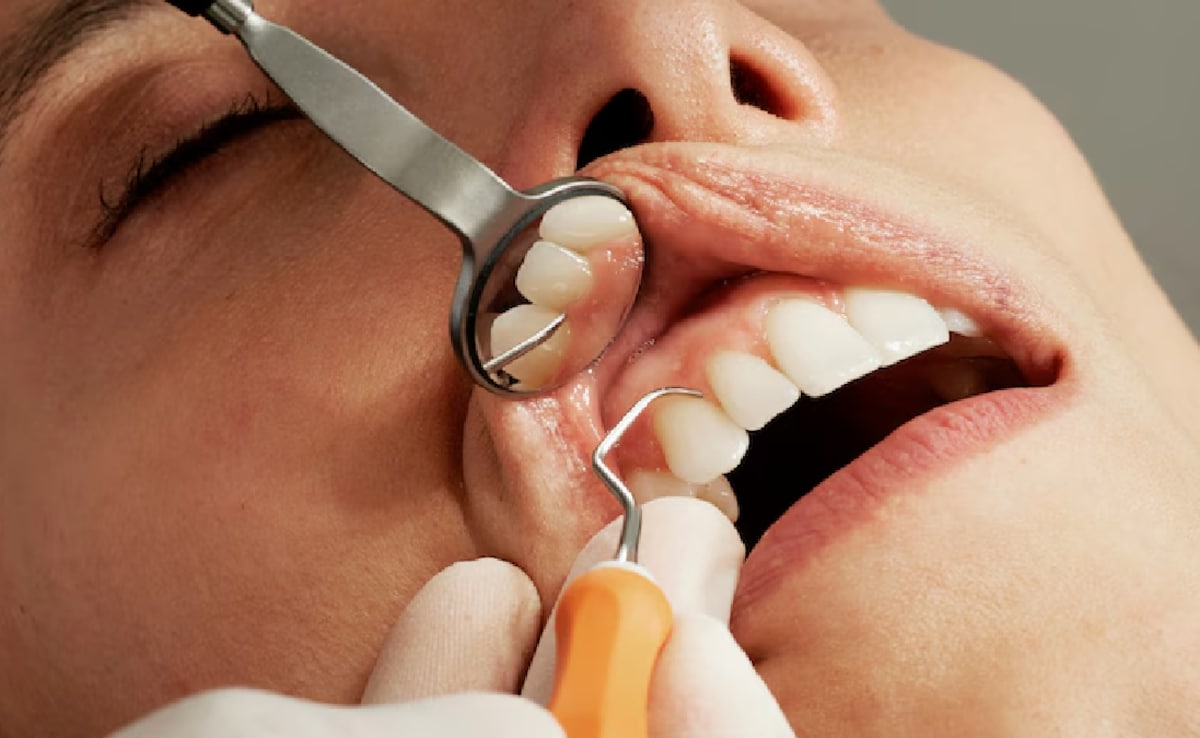Dentist explains why your teeth enamel matters, 11 reasons it wears off