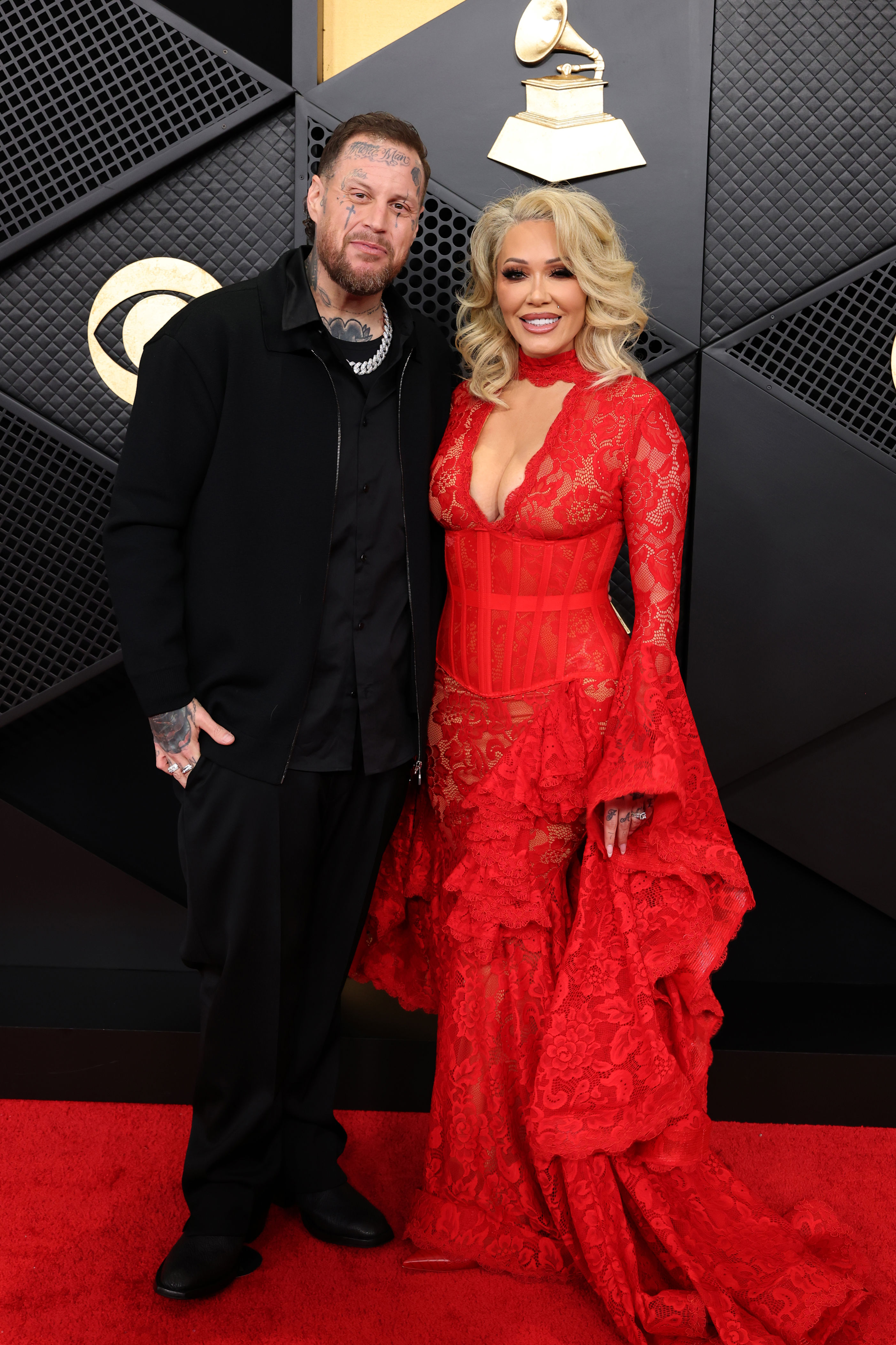 Jelly Roll’s wife, Bunnie Xo, reveals terrifying side effect of taking ...