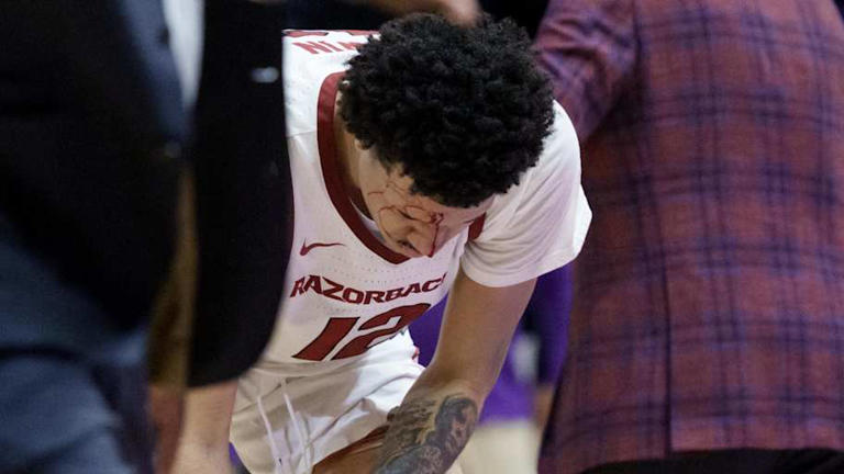 Will John Calipari's hogs have full rotation as Arkansas faces Auburn?