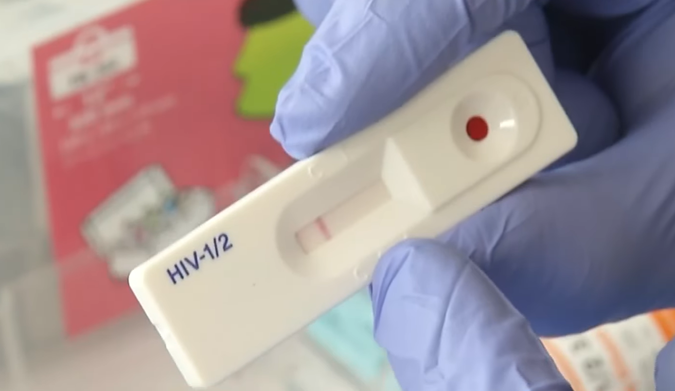 hiv-testing-kits-likely-to-be-awarded-by-end-of-september