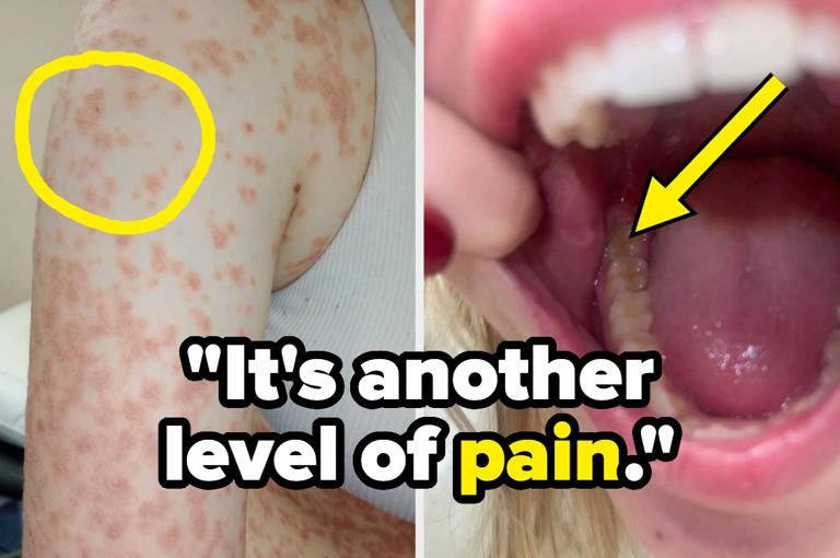 People are sharing the seemingly minor medical issues that majorly ...