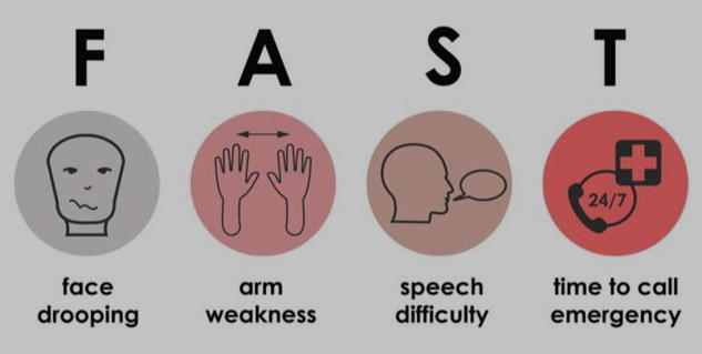 Stroke symptoms explained: 5 signs that demand immediate action