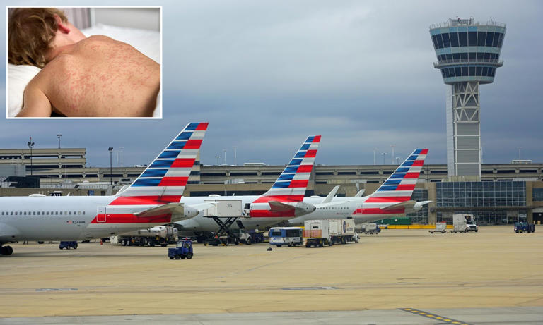 Thousands of travelers at major US airport exposed to measles as ...