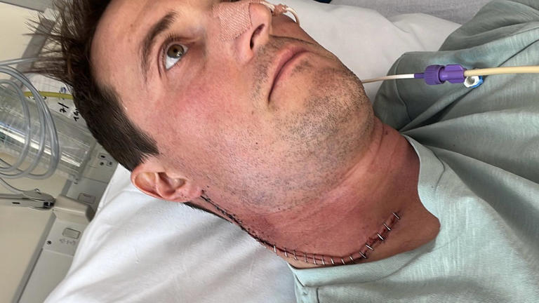 Durante la operación, los cirujanos le extirparon 44 ganglios linfáticos de su cuello.