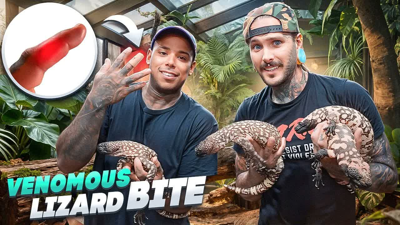 Josh was bitten by a venomous beaded lizard - what happened next