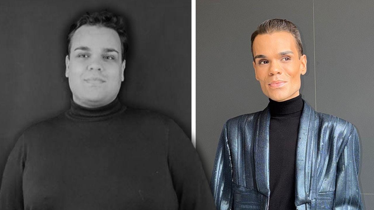 Após perder 70 quilos, Zé Lopes desabafa: 