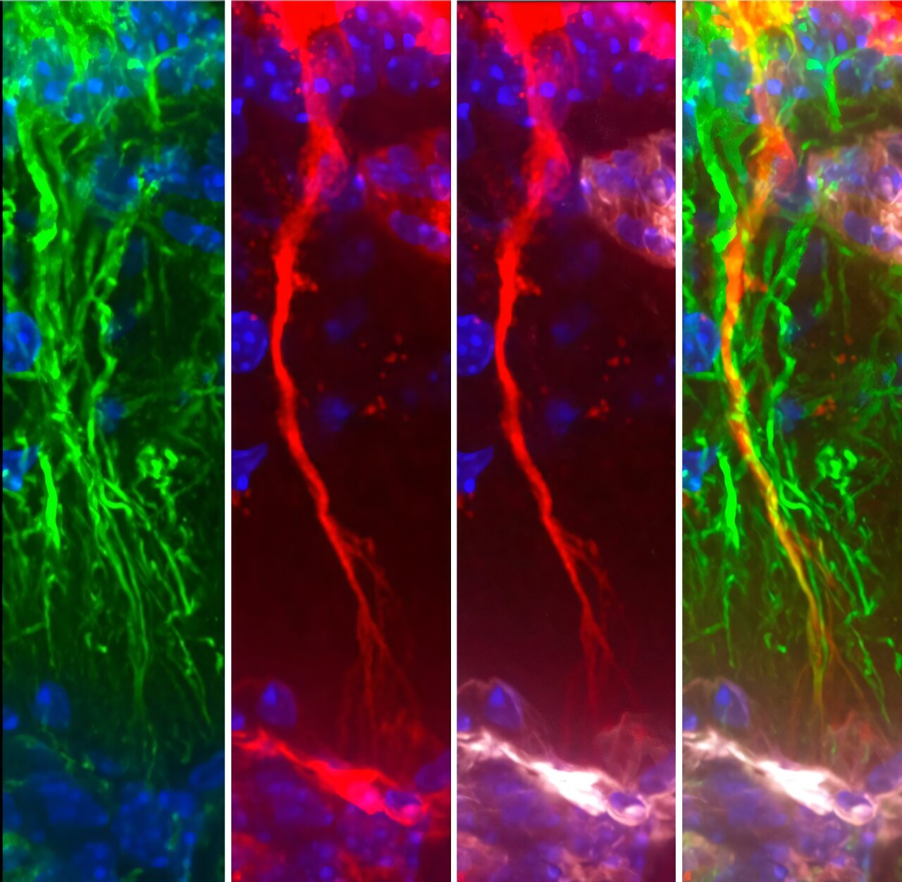 Brain-clearing cells offer clues to slowing Alzheimer's disease progression