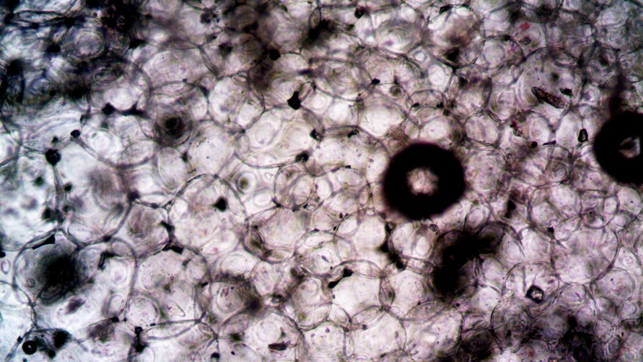 Cyborg cell clusters may turbocharge hunt for a type 1 diabetes cure