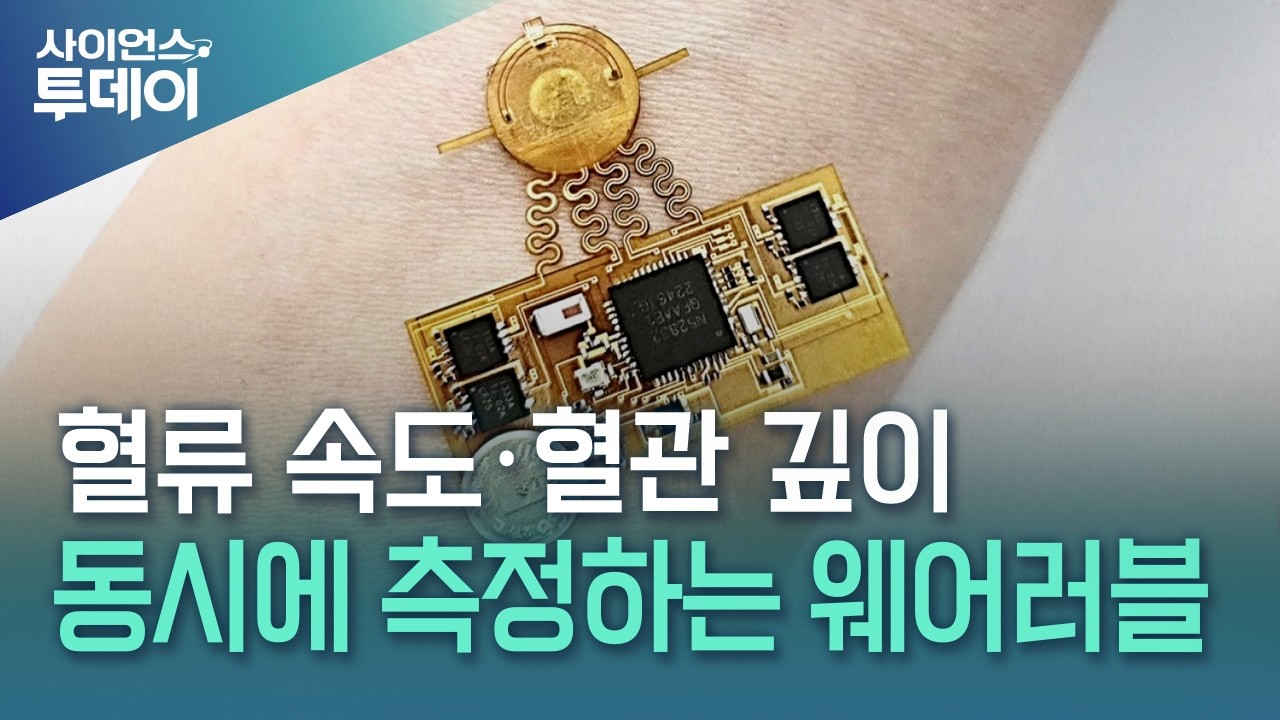 혈류 속도·혈관 깊이 동시에 측정하는 웨어러블 기술 개발 / YTN 사이언스