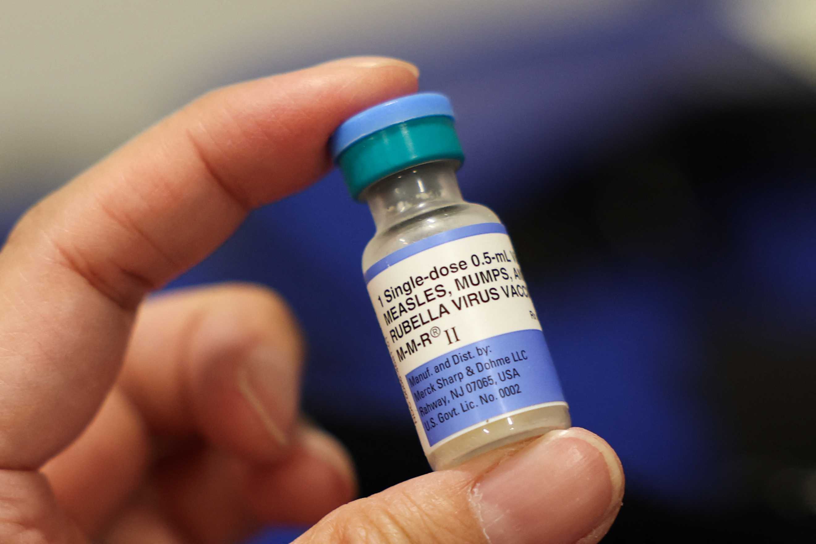 It's not just measles. Mumps are on the rise, too. A doctor explains ...