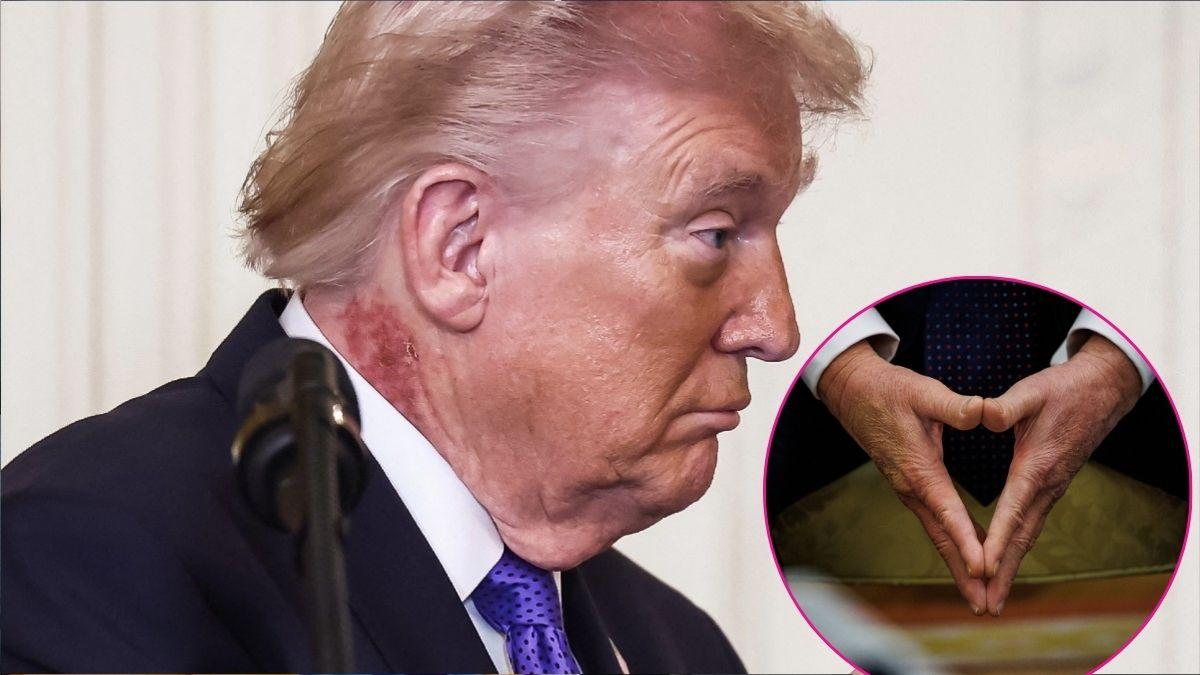 Donald Trump slathers makeup on his hand — but doesn't cover up his ...