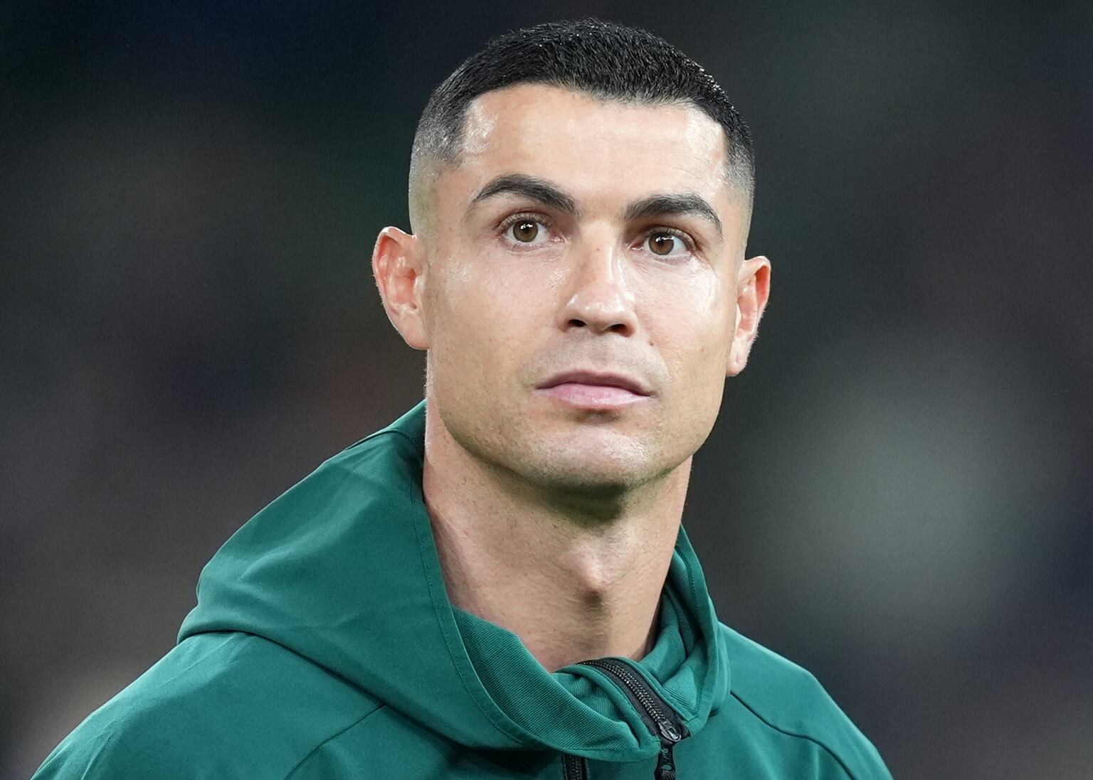 Cristiano Ronaldo's hamstring injury more serious than expected