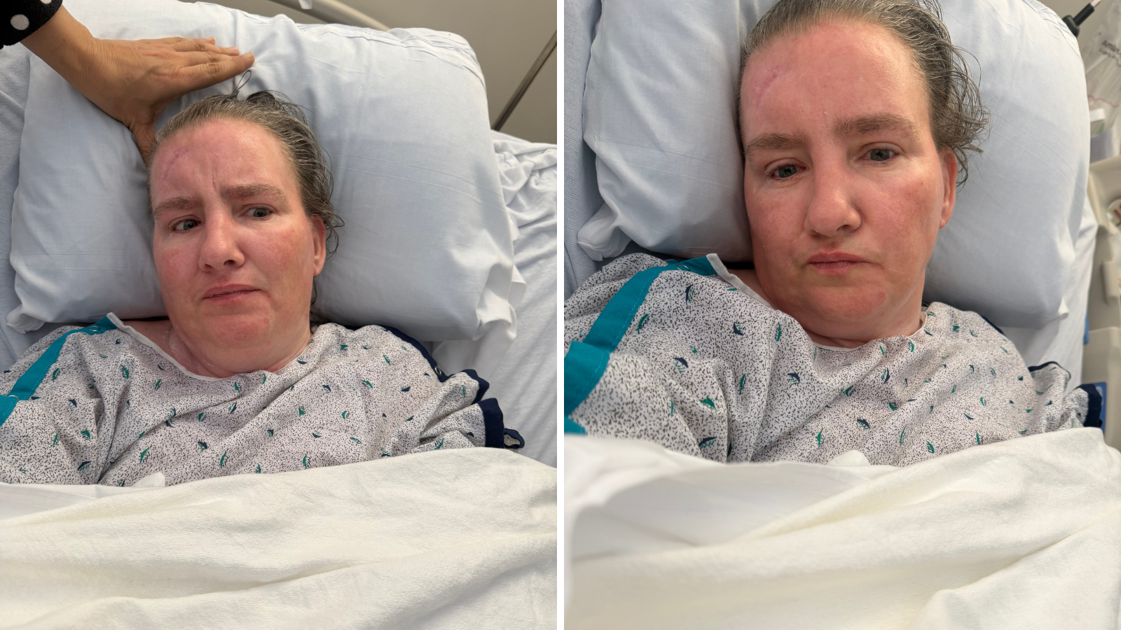 Police ask for public's help in identifying woman struck by car in ...