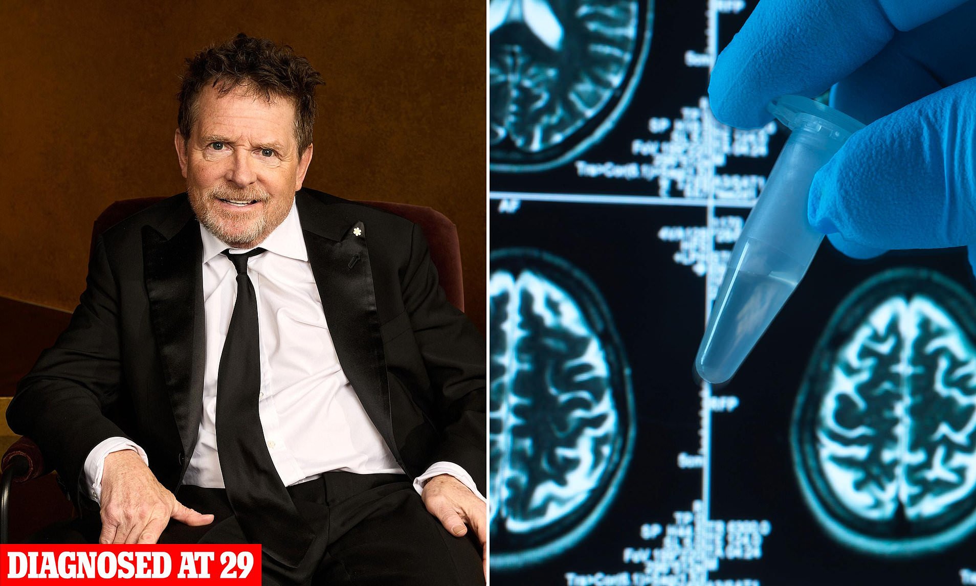 New possible cause of Parkinson's discovered as experts race to answer ...