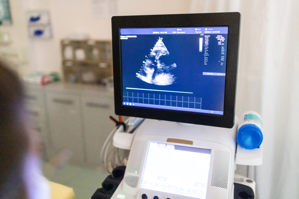 Why cardiologists recommend a specific scan for heart health after 40
