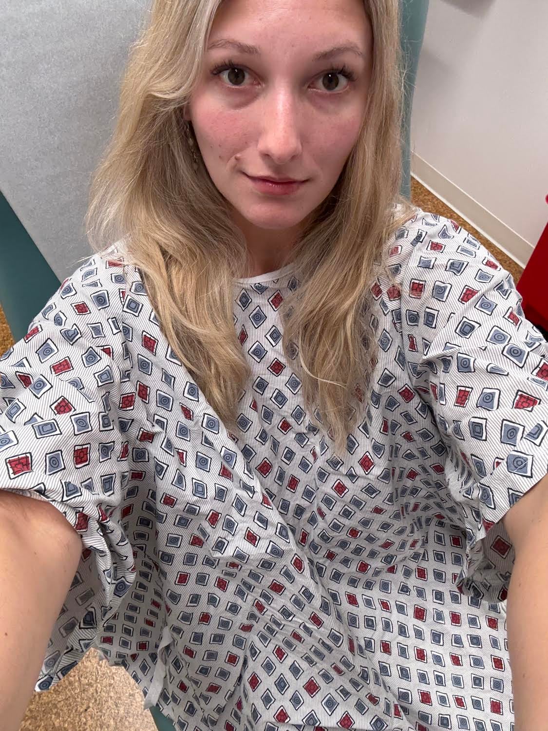 I thought a mole was harmless until my doctor voiced cancer concerns