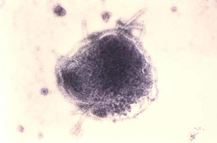 Virus campak.