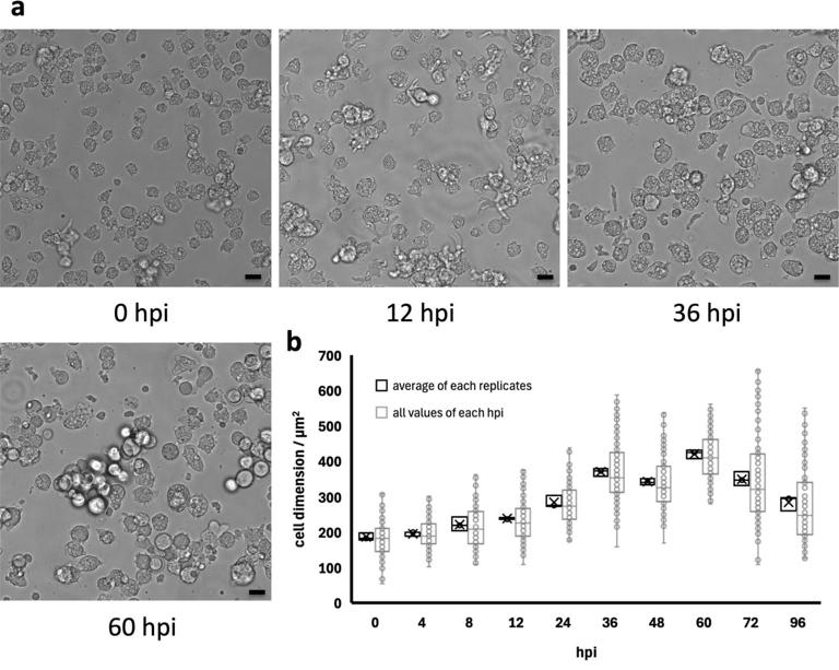 Discover Ushikuvirus, a giant DNA virus that could reshape cellular ...