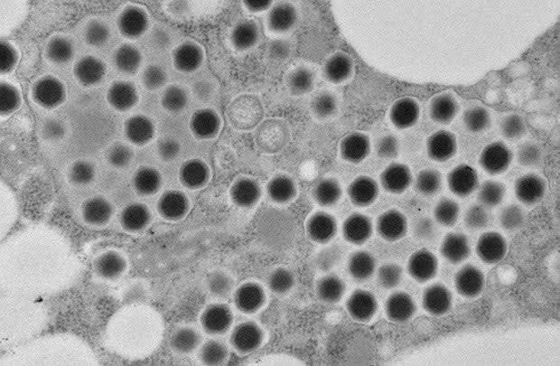 Discover Ushikuvirus, a giant DNA virus that could reshape cellular ...