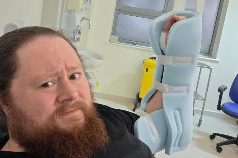 Coventry man's nightmare spider bite that left him in hospital for five ...