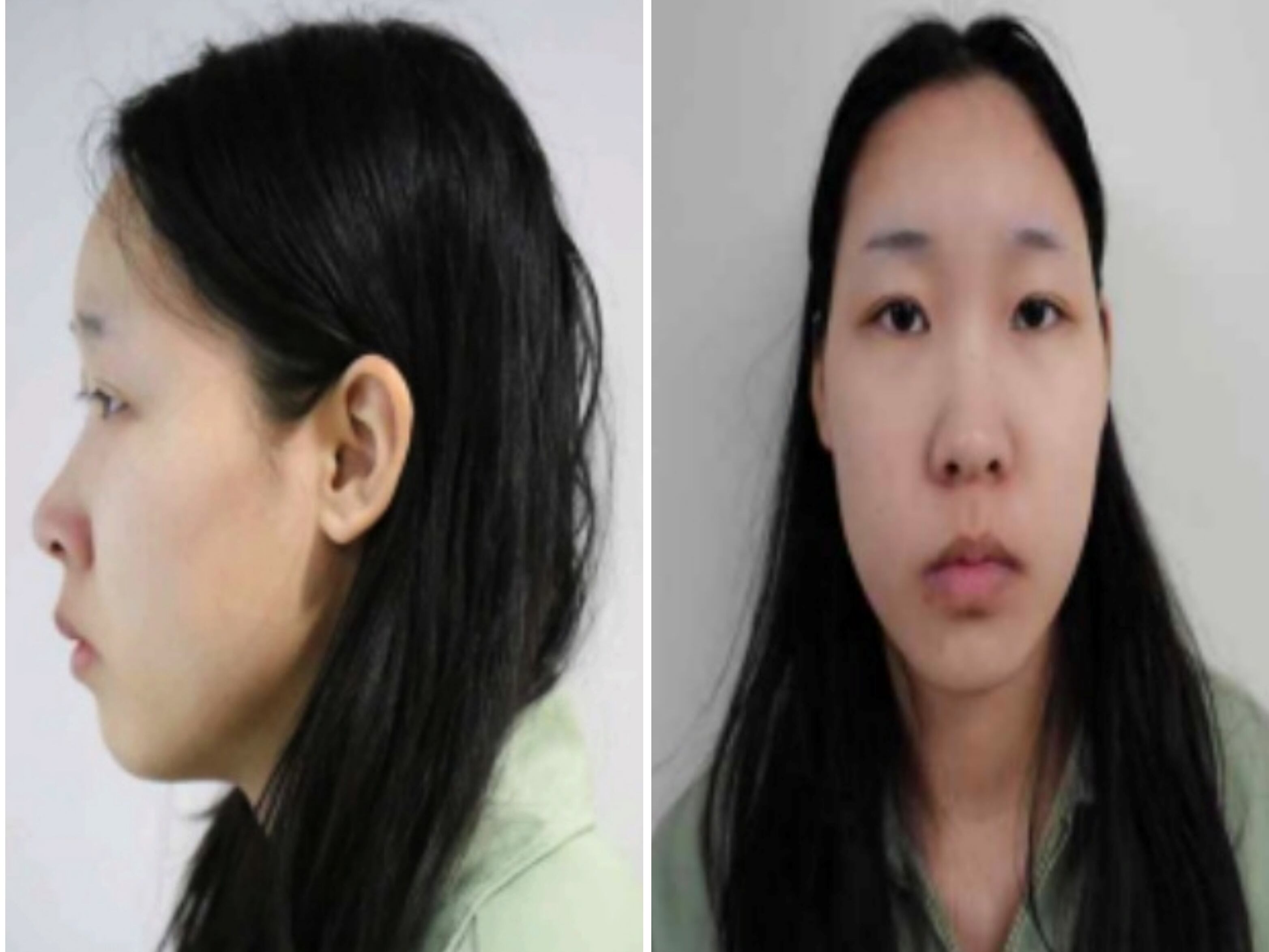‘강북 모텔 연쇄 살인’ 피의자 신상 공개… 20세 김소영