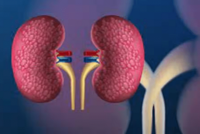 Kidney Health: If you want to keep your kidneys healthy, then adopt these 8 golden rules today, you will not even need a doctor.