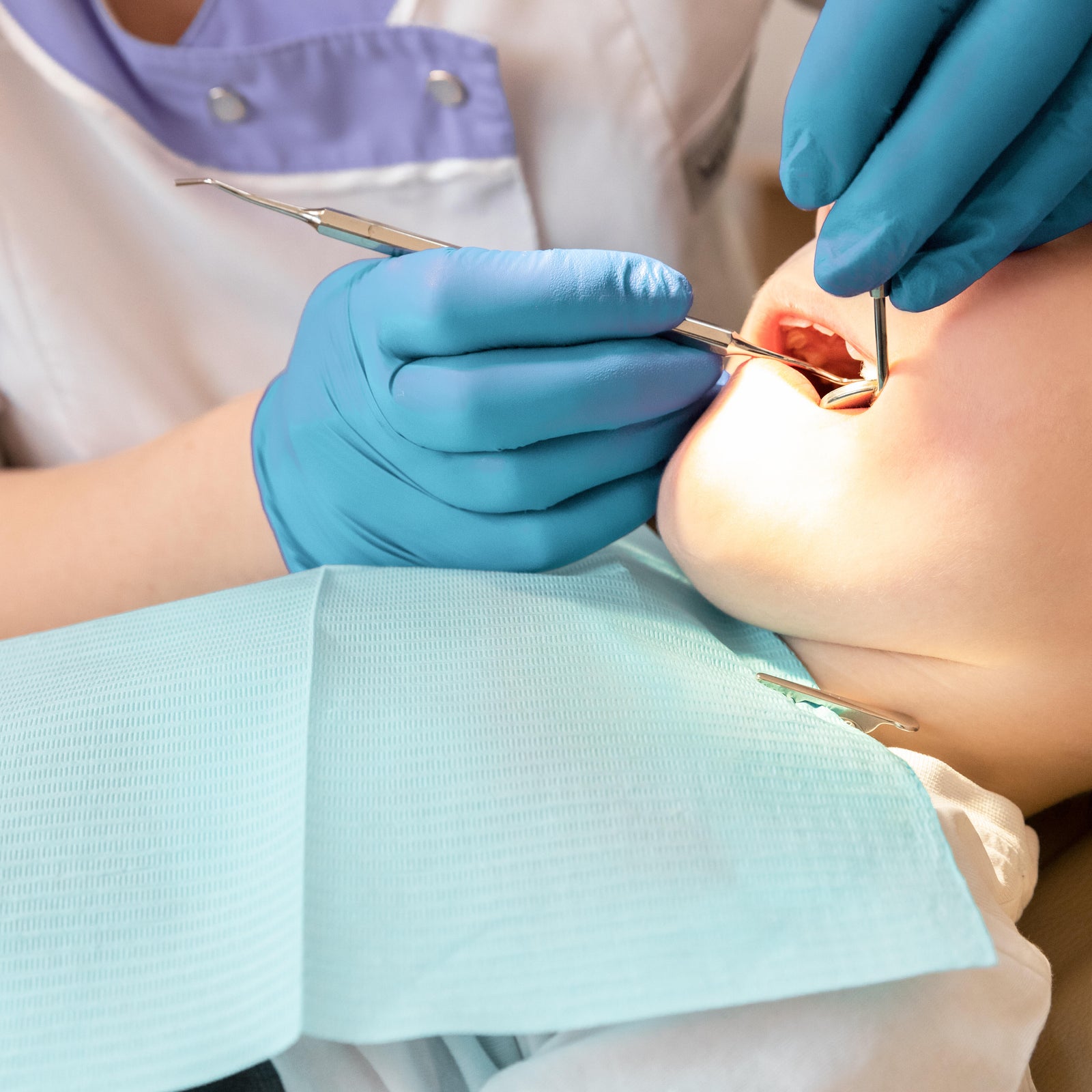 More kids are in ERs for tooth pain. Budget cuts and fluoride fights aren