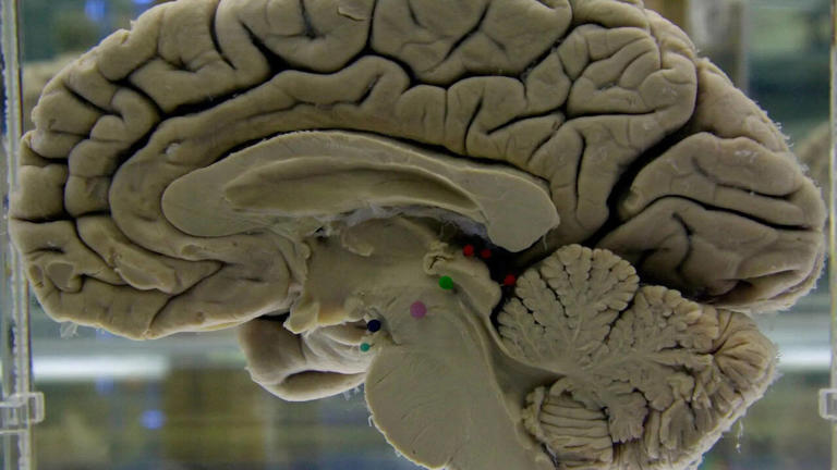 Strategies for enhancing brain health through lifelong learning