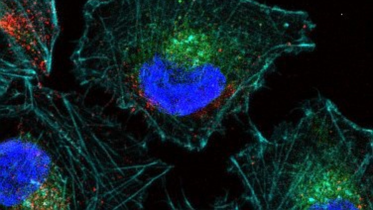 Newly found giant DNA Ushikuvirus may offer clues to cell evolution