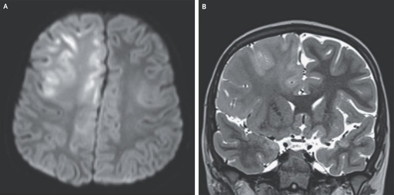 Boy, 7, dies of brain condition caused by world’s most contagious ...