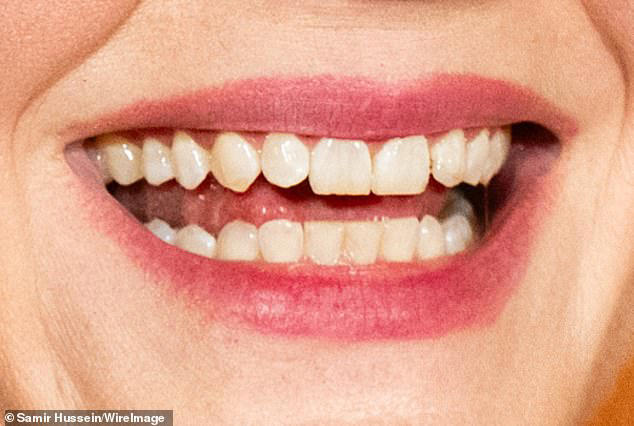 Experts reveal what perfect teeth look like - and which stars could do ...
