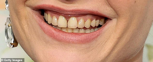 Experts reveal what perfect teeth look like - and which stars could do ...