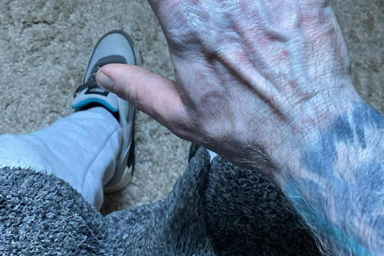I was rushed to A&E after waking up with blue skin - but medics started ...