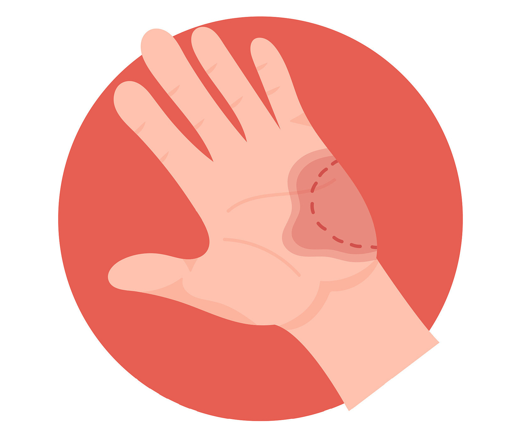 Bị người có nguy cơ bệnh dại gây chảy máu, liệu có nhiễm bệnh?