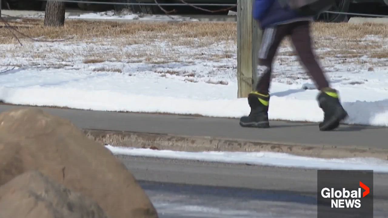 Northeast Calgary hit and run leaves child with broken leg: police