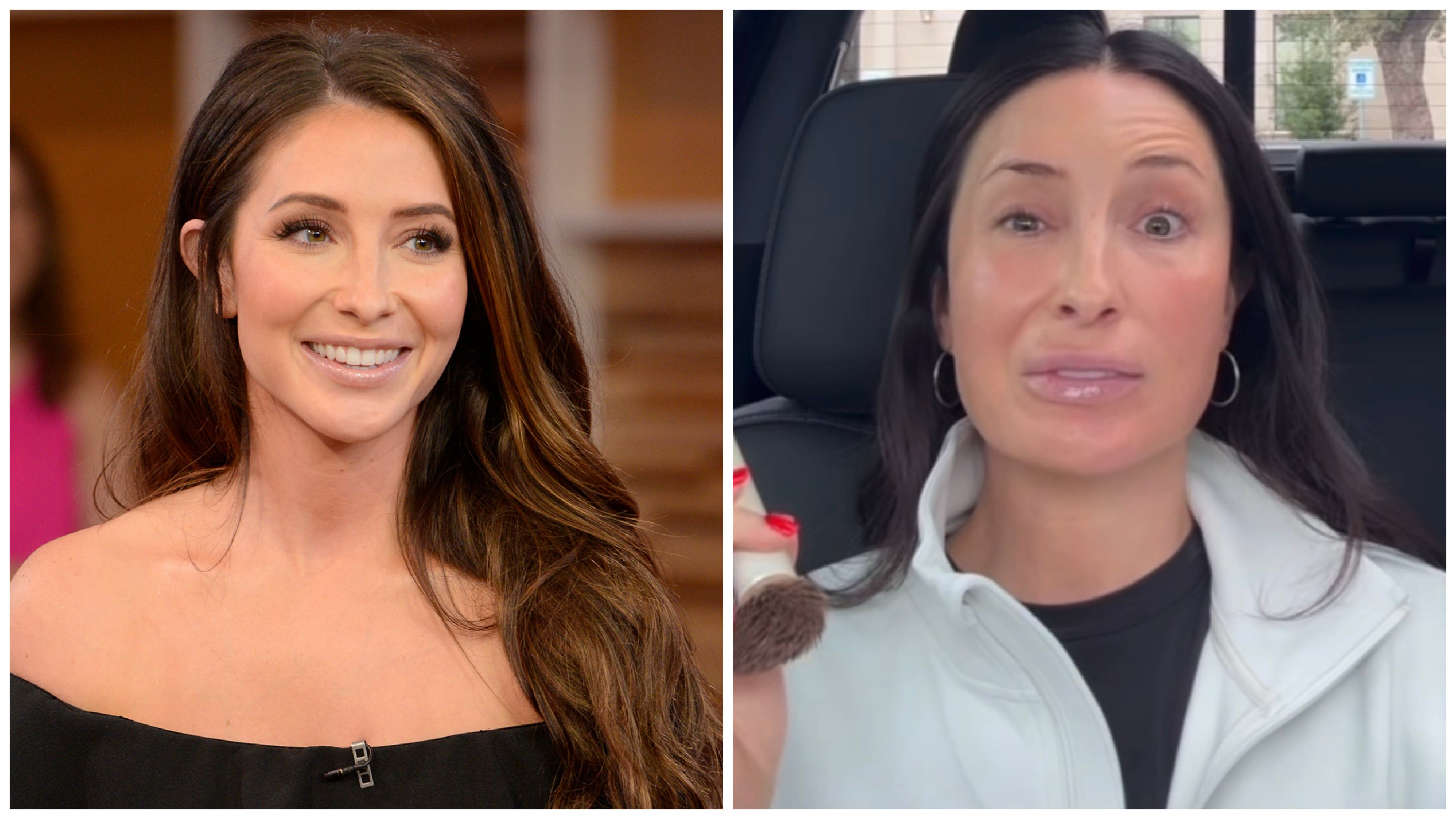 Bristol Palin shares update on year-long battle with facial disfigurement<br><br>