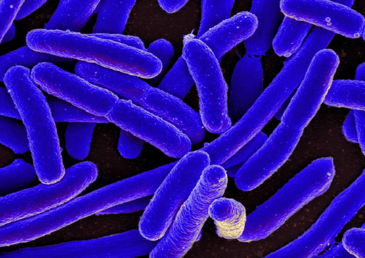 Early detection after E coli outbreak at Calgary daycares prevented ...