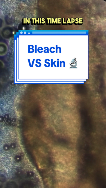 Bleach and soap under the microscope, science explained