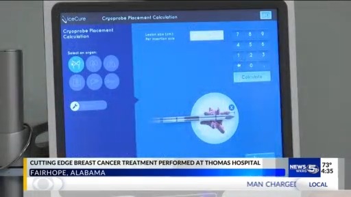 Cutting edge treatment at Thomas Hospital freezes breast cancer tumors ...