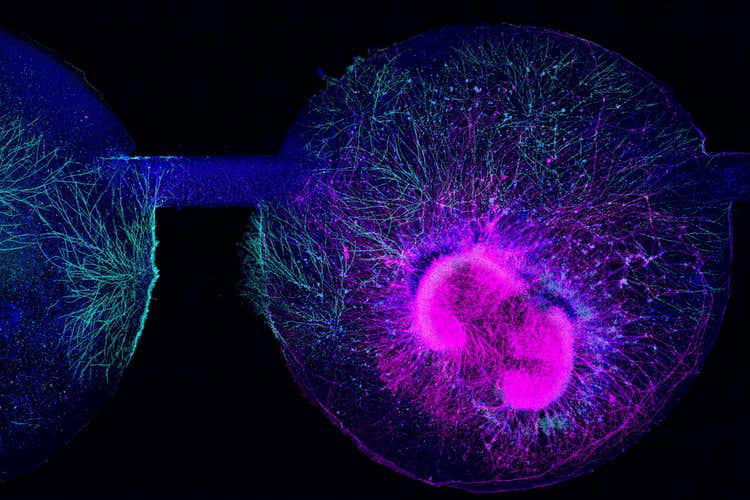 Stem cell patch reverses brain damage in fetuses with spina bifida