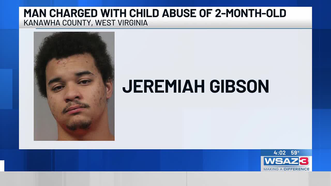 Man charged with child abuse of 2-month-old