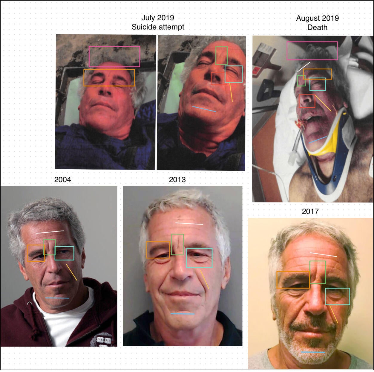 Comparison of facial features in photos of Jeffrey Epstein from 2004, 2013, 2017, July 2019 and after his death in August 2019. / Credit: U.S. Department of Justice qhiukiqrihrinv